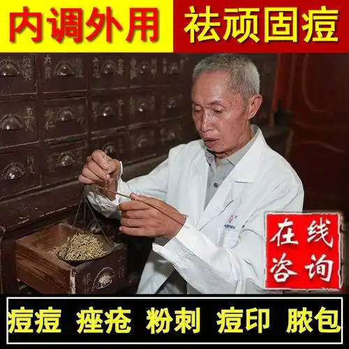 共454 件祛痘中药膏相关商品