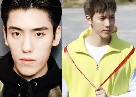 王子异整容前后图片对比为什么整容 王子异个人资料家庭背景富二代