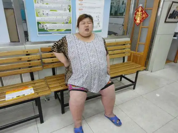 辽宁第一胖女孩一年要减200公斤长春康达