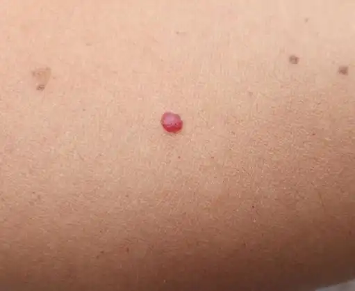 樱桃痣,请自报家门,我从来不滥杀无辜