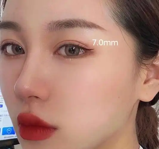 小平行双眼皮yyds大家看看自然不