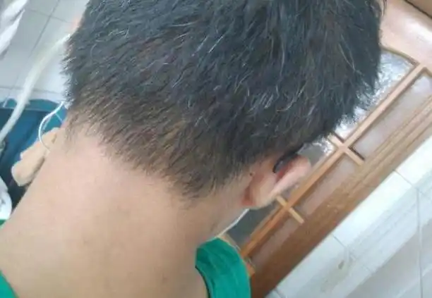 白发长在哪,病就从哪出?长在前额,两鬓,后脑勺,分别暗示什么