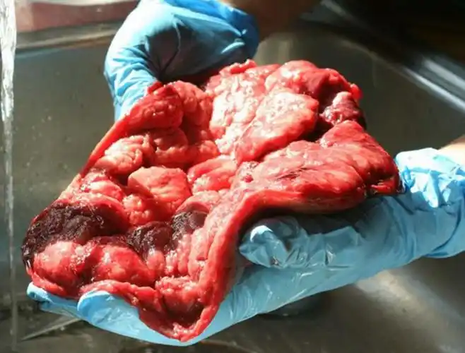 人胎盘详细的特征图片