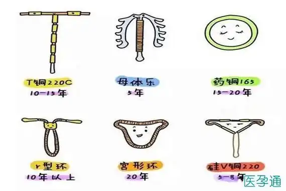为什么上环节育器能避孕节育器有几种附图片