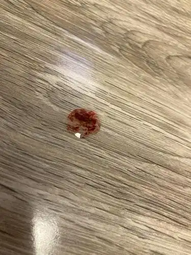 【讨论】【求助】刚刚发现地上一滴黏糊糊有血的液.