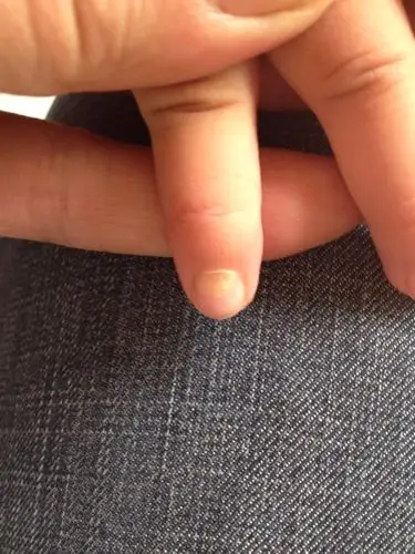 我女儿今年2岁半,今天突然发现有2个指甲从根部发空(见图),很是费解?