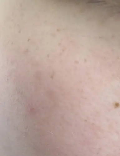 请问什么是正常的皮肤啊,有时候都不太想照镜子.