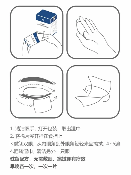 眼部除螨湿巾使用方法眼睛除螨湿巾哪个牌子好