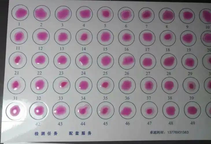 2,如果出现少量凝集反应为阳性,一般再去采血复检.