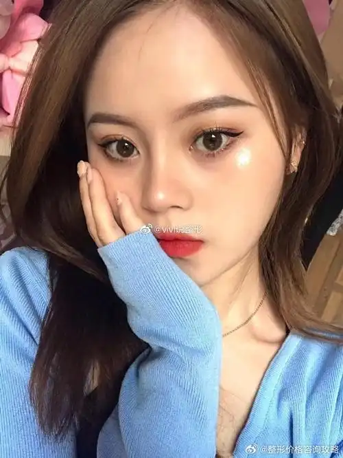 已经处于稳定状态了,基本上也没太大的变化了,鼻子立体有自然,很好