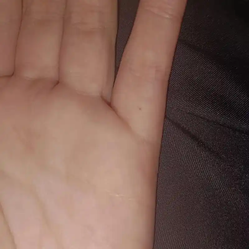 左手小指好像突然长了一颗痣 是怎么回事啊