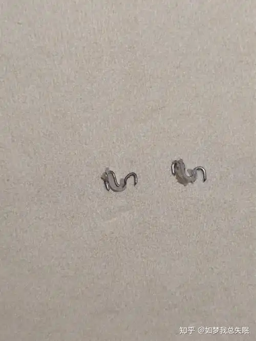 包皮手术亲身经历吻合器20220426术后一年多已完全恢复持续更新中