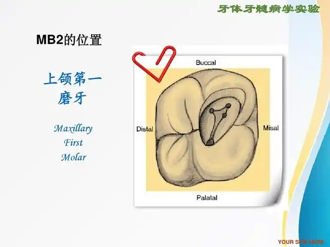 卫生 临床医学 rct根管治疗ppt 牙体牙髓病学实验 mb2的位置 上颌第一