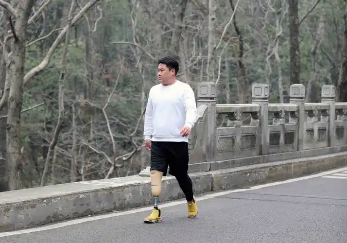 半足假肢多少钱足截肢患者如何装配半足假肢