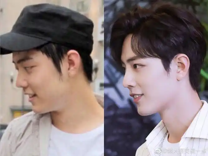 又来了 又来了 说肖战山根二次发育的人是真不知道.