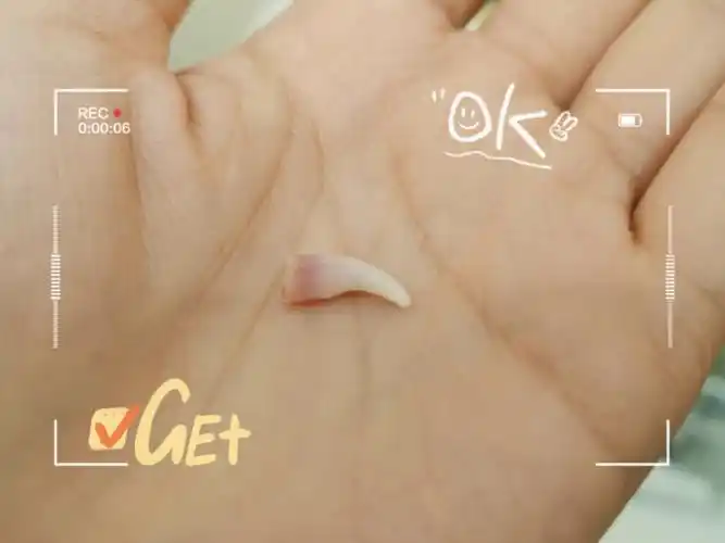 有幸捡到小虎牙一颗