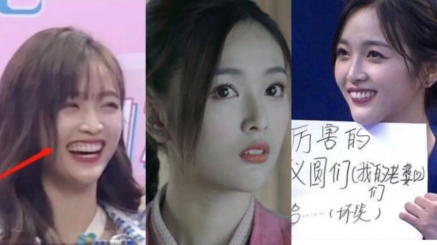 明星放弃烤瓷牙吧看吴宣仪摘掉假牙后颜值秒回春
