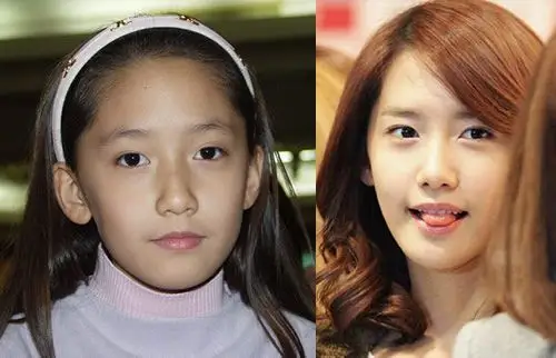 林允儿整容了吗 林允儿整容前后对比照片曝光
