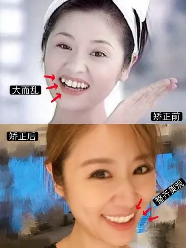 提起林心如,大家对她的第一印象肯定是还珠格格里那个眼睛布灵布灵的