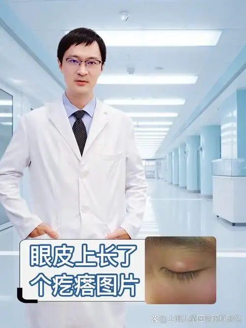 眼皮上长了个疙瘩图片  眼皮上长了个疙瘩虽然是一种较为常见的眼部