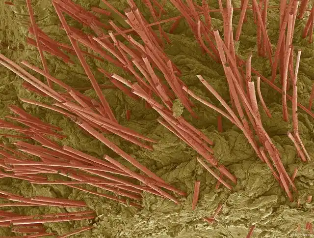 表皮层又分为五小层:角质层,透明层,颗粒层,棘状层,基底层.