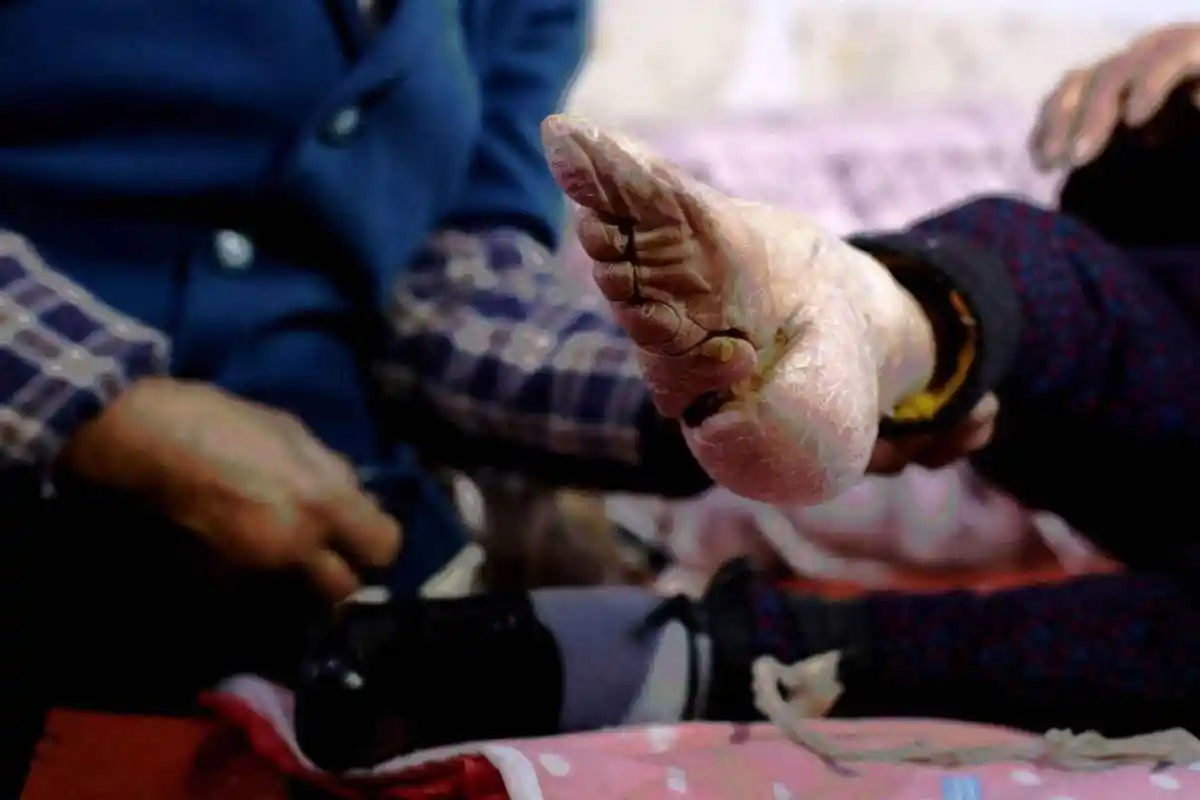 裹脚对古代女性的影响有多大?