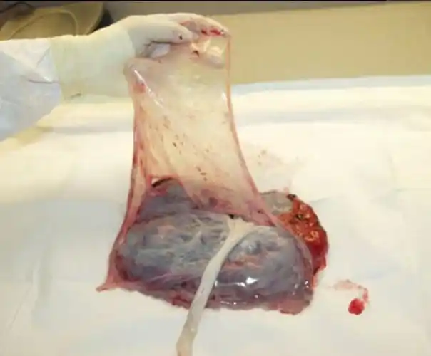 包含vsta胎盘提取人体干细胞美容的词条