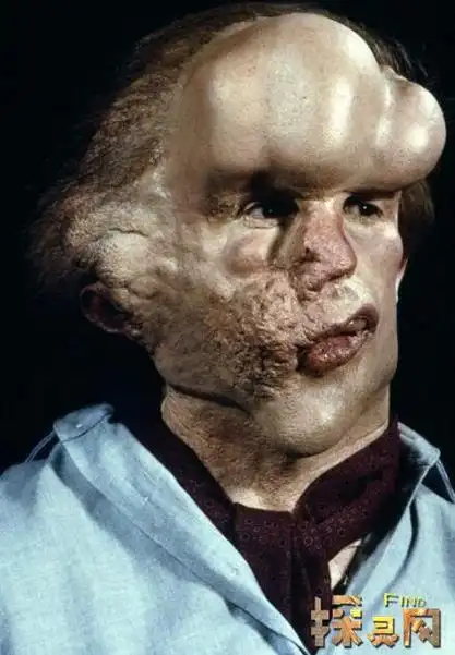 世界最可怕的变异人盘点人类史上的十大怪胎图片3
