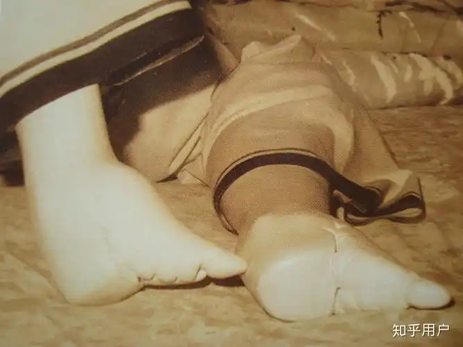 缠足后的脚有没有符合现代审美的图片? - 知乎