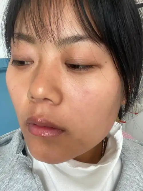 92年苹果前置原相机素颜真吓人