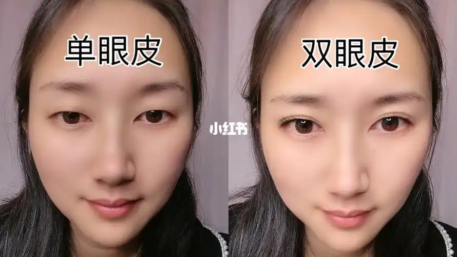 单眼皮和双眼皮差距好大