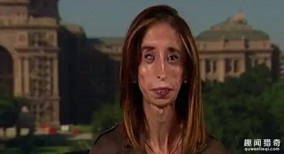 她被人称为是世界上最丑的女人拍片教大家勇敢