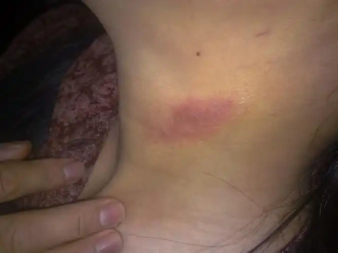 患者信息:女50岁河南南阳病情描述(发病时间,主要症状等):十几年前