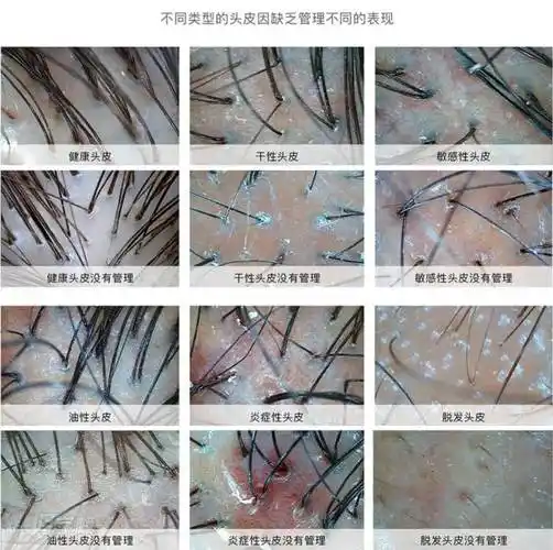 韩辰怡美头皮管理培训课程