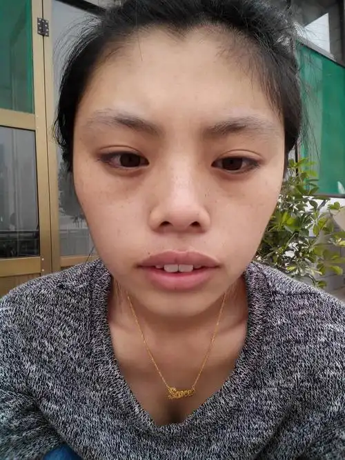 我额头窄颧骨高下颚宽适合什么发型.求建议!先谢谢了.