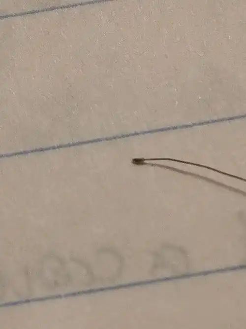 发根那里的小白点是毛囊吗?