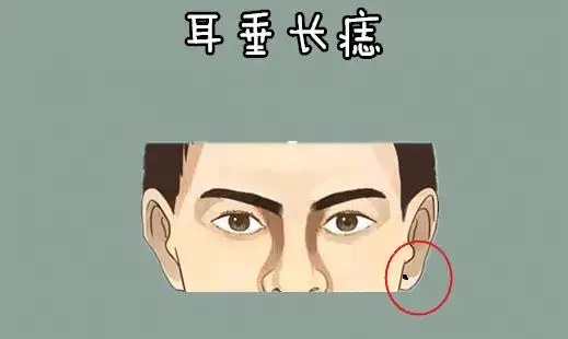 身体5颗横财痣,男人车房不愁,女人发财不愁,马上走大运!