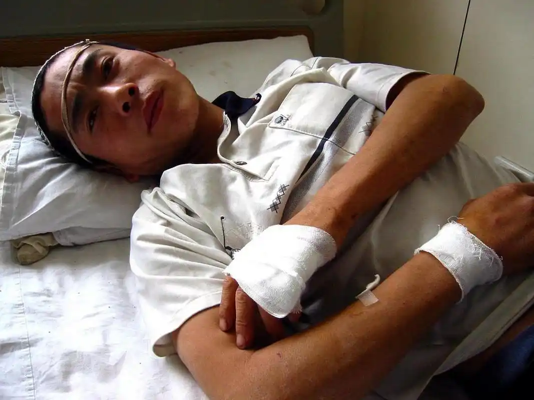 前年我一个厂区的同事高空作业时踩空导致高空坠落伤得特别严重,我