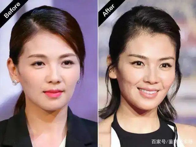 刘涛:高颧骨女星的颜值沉浮!