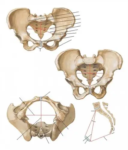 新曲线squeen产后恢复中心产后专业科普系列一骨产道重塑