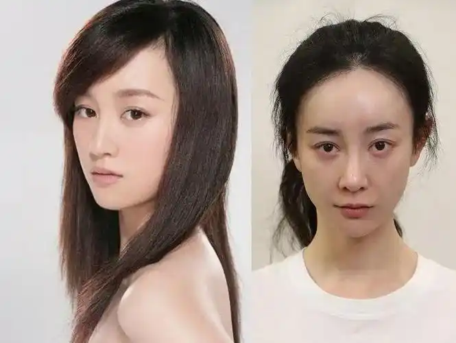 娱乐圈的几大天然美女,整容失败,断送事业前途|张檬|整容|张萌_新浪