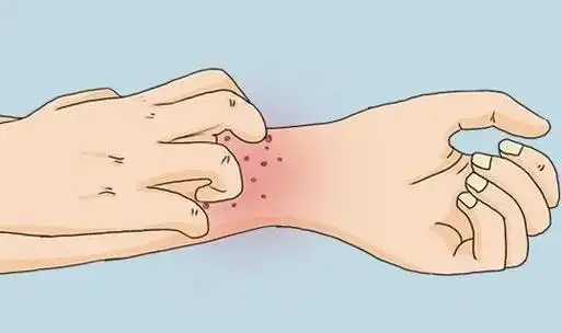 冬季皮肤瘙痒做对这几件事远离皮肤问题