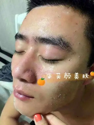 更正确的做法是下班回家的第一时间就卸妆护肤,不要等到睡前再做,这样