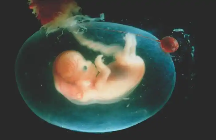 并排出婴儿肺部的液体 这包括从胎盘中渗出的水,但是当 羊水过高时,这