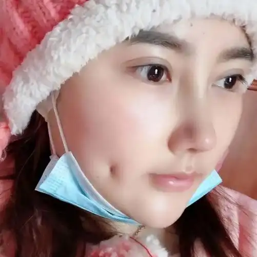 据说有酒窝的女孩子一笑都很治愈甜美加倍的人造酒窝美人