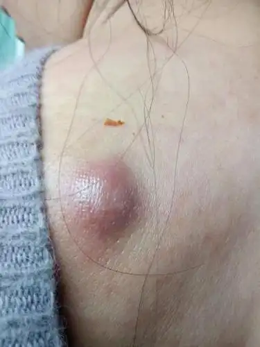 发现老公保留前女友的照片几张,你会怎么样做/ 背