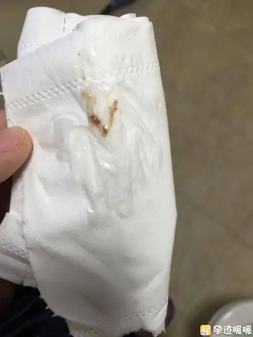 孕11周出现血色白带!