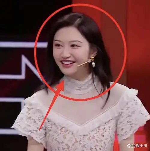 景甜整容大变样,脸部僵硬微笑唇太违和,人间富贵花可惜了!