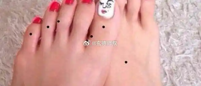 脚上各个位置的痣代表的含义你们都知道吗?