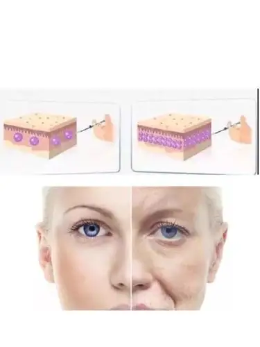 如何避免额头,泪沟,苹果肌等部位成为脂肪填充的重灾区?